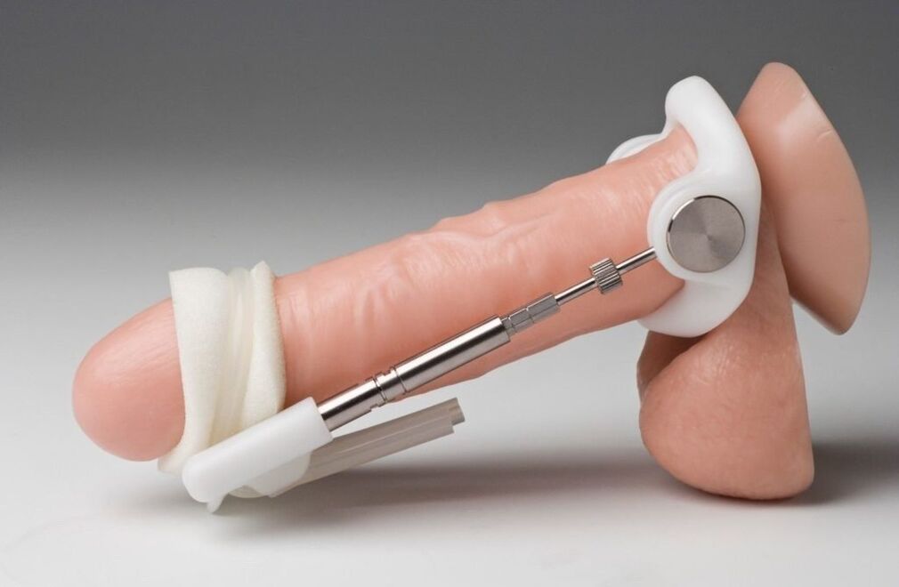 Extended to increase the thickness of the penis